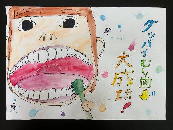 グッバイむし歯　大成功
